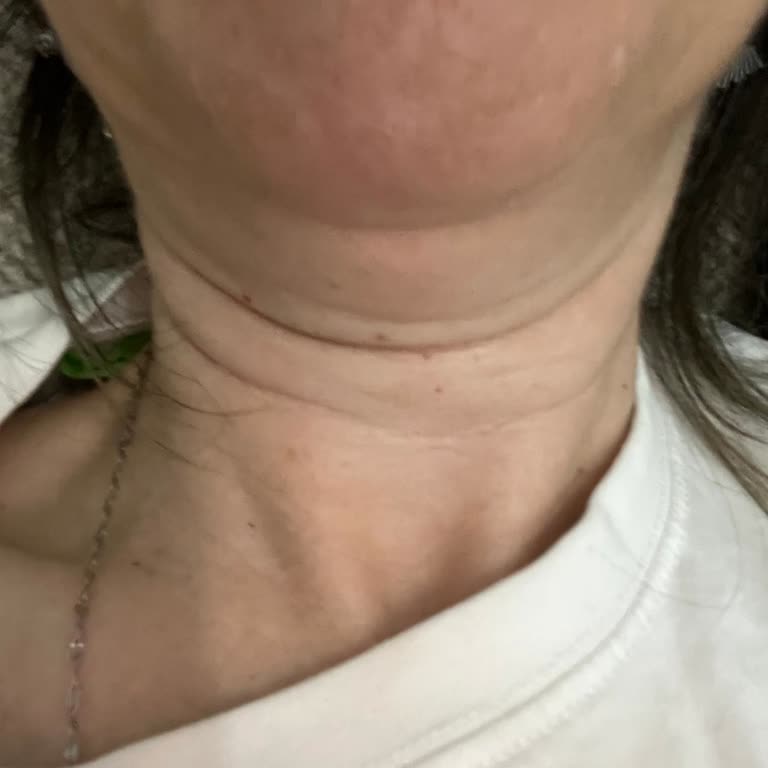 Surp Pirgiç Ermeni Hastanesi Yetersiz Muayene Ve Haksız Ücret Tahsili