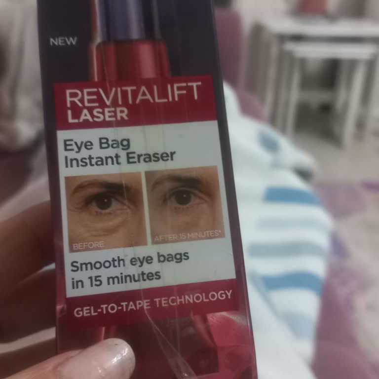 Göz Altı Kremi Ciddi Yanma Ve Tahrişe Sebep Oldu