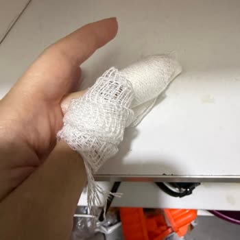 Hijyen Eksikliği Nedeniyle Tırnak İşleminden Sonra Ciddi Enfeksiyon Ve Mağduriyet Yaşadım