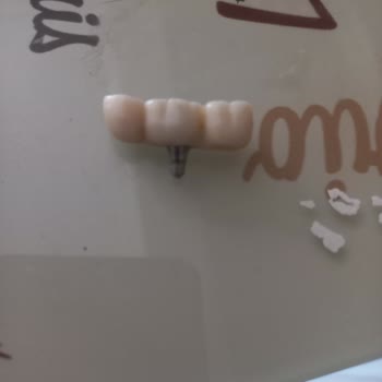 Nara Dent İstanbul Hatalarının Sorumluluğunu Almıyor