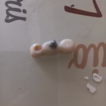 Nara Dent İstanbul Hatalarının Sorumluluğunu Almıyor