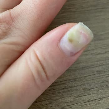 Fatma Çağlar Beauty Sağlık Açısından Kesinlikle Hijyenik Değil!