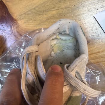 Garanti Kapsamındaki Ayakkabılarda Hızlı Deformasyon Ve İade Talebim Reddedildi