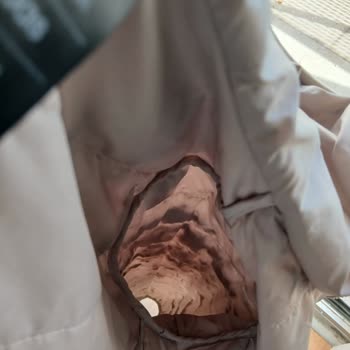 Kısa Sürede Bozulan Ceket İçin İade Talebi