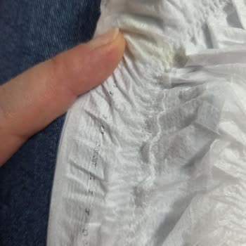 Molfix 6 Numara Bezlerde Tekrarlayan Bacak Kısmı Sızdırma Sorunu Yaşadık