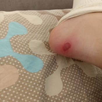 Sağlığımı Bozan Bot İçin İade Talebim Reddedildi Mağdur Edildim