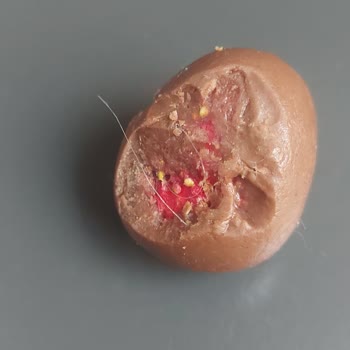 Çilekli Drajenin İçinden Kıl Çıkması Nedeniyle Hijyen Endişesi