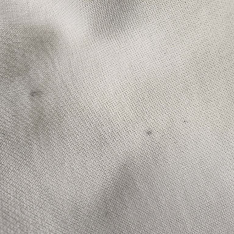 Yeni Alınan Tunik Pantolon Takımında Belirgin Lekeler Çıktı