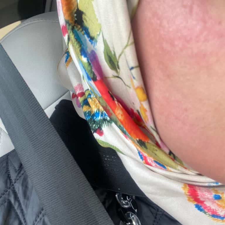 Yüz Lazer Tedavisinde Beklenen Sonucu Alamadım, Mağdurum