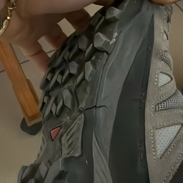 Kısa Sürede Topukta Çatlama Ve Olumsuz Değişim Sonucu