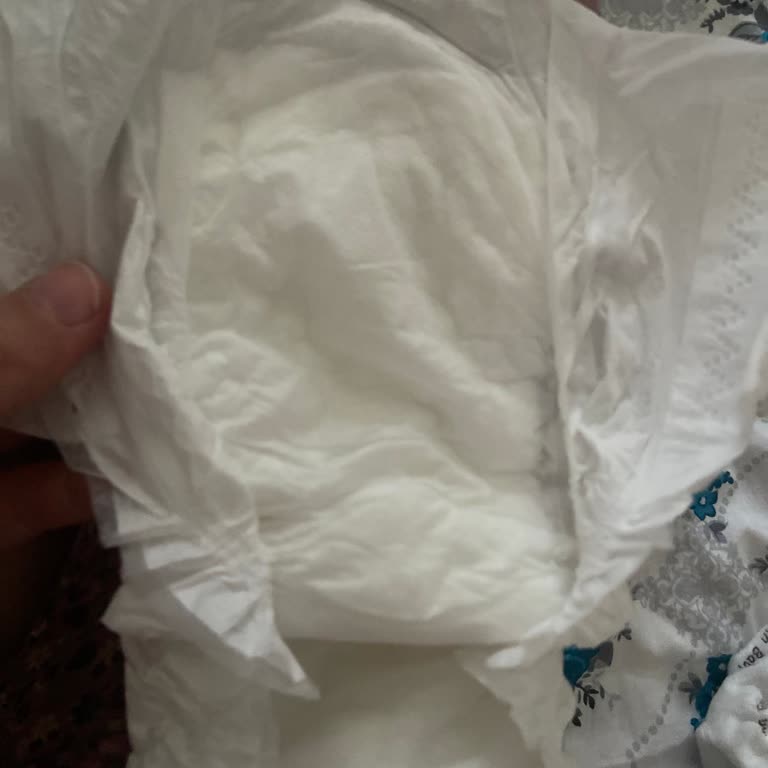 Sleepy Bebek Bezinde Topaklanma Ve Müşteri Hizmetine Ulaşamama