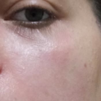 BİM Bebek Şampuanında Cilt Yanması Ve Güvenlik Endişesi!