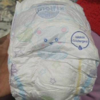 Molfix 5 Numara Bebek Bezinde Kum Taneleri Ve Sağlam Ürün Talebi