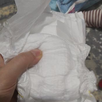 Molfix 5 Numara Bebek Bezinde Kum Taneleri Ve Sağlam Ürün Talebi