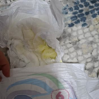 Molfix 6 Numara Bezde Sürekli Parçalanma Ve Güven Kaybı