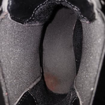 Ayıplı Ürün Nedeniyle Sağlık Ve Maddi Mağduriyet: Değişim Talebim Reddedildi