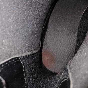 Ayıplı Ürün Nedeniyle Sağlık Ve Maddi Mağduriyet: Değişim Talebim Reddedildi