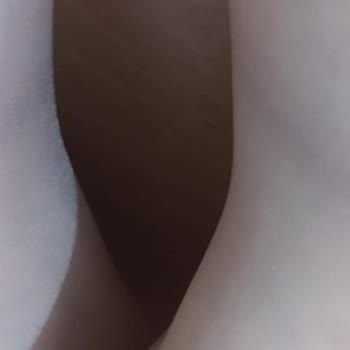 Aldığım Bot Hem Acı Verdi Hem Boya Bıraktı, İade Talebim Reddedildi