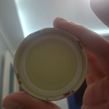 Bebek Gıdası Kavanoz Kapaklarında Hızlı Paslanma: Sağlık Riski Ve Acil İnceleme Talebi