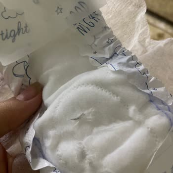 Pedin İçinden Çıkan Yabancı Cisim Kadın Sağlığını Tehlikeye Atıyor