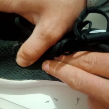 Adidas Ayakkabının Yanları Açıldı, Değişim Talebim Reddedildi