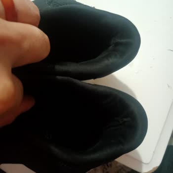 Adidas Ayakkabının Yanları Açıldı, Değişim Talebim Reddedildi