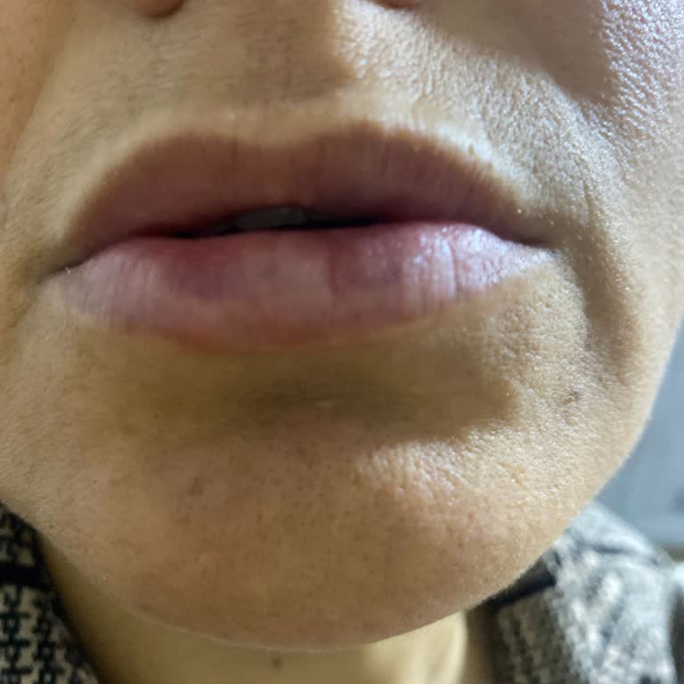 Nils Güzellik Merkezi | Van Sağlık Açısından Ve Psikolojik Olarak Olumsuz Etkilendim!