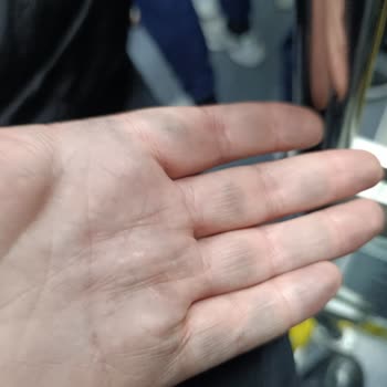 Otobüslerde Sürekli Yetersiz Temizlik Ve Hijyen Sorunu