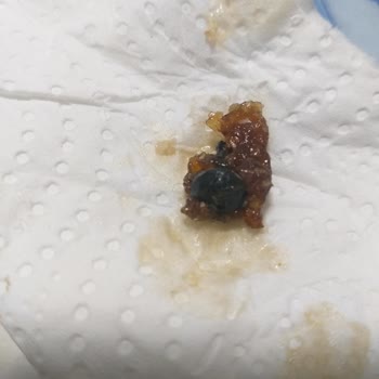 Lokumdan Vida Çıktı, Kuruyemişler Bayat: Gıda Güvenliği Tehlikesi