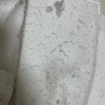 Siparişimde Ürün Eksikliği Ve Kalite Sorunu Yaşadım