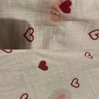 Yanlış Veteriner Müdahale Sonrası Köpeğimde Kalıcı Hasar Ve İkinci Ameliyat