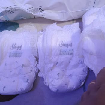 Sleepy Bio Natural Bebek Bezlerinde Üretim Hatası Ve Mağduriyet