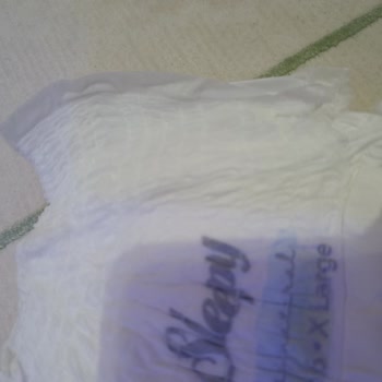 Sleepy Bio Natural Bebek Bezlerinde Üretim Hatası Ve Mağduriyet