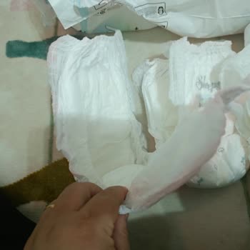 Sleepy Bio Natural Bebek Bezlerinde Üretim Hatası Ve Mağduriyet