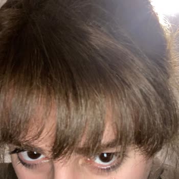 Saç Boyası Saçlarımı Koyulaştırdı Ve Kuruttu, Mağduriyetimin Giderilmesini İstiyorum