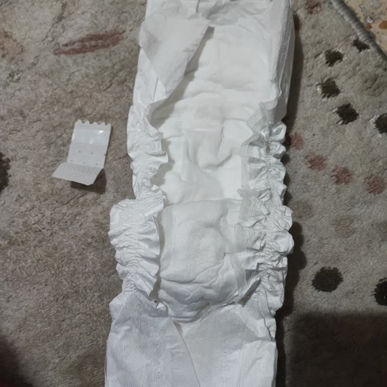 Sleepy Bio Natural Bebek Bezlerinde Yapışkan Bant Sorunu Ve Mağduriyet