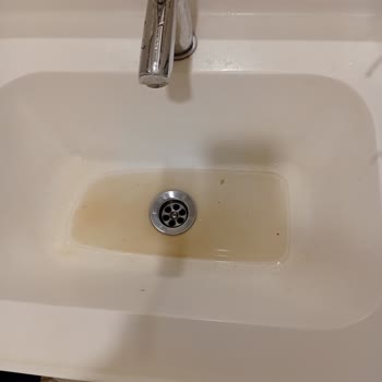 Ankara Bilkent Şehir Hastanesi'nde Koltukların Hijyen Ve Bakımsızlık Sorunu