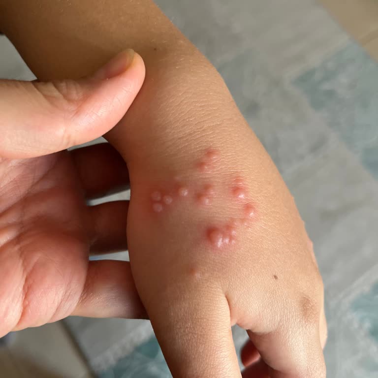 Klamer Şurubun İçeriğinin Ve Yan Etkilerinin Detaylı Şekilde İncelenmesini İstiyorum