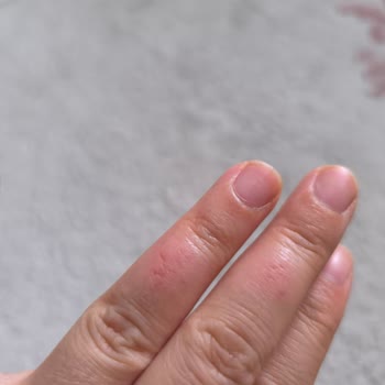 Glint Temizlik Ürünü Fırınıma Ve Sağlığıma Ciddi Zarar Verdi