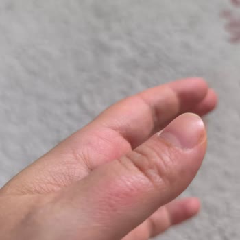Glint Temizlik Ürünü Fırınıma Ve Sağlığıma Ciddi Zarar Verdi