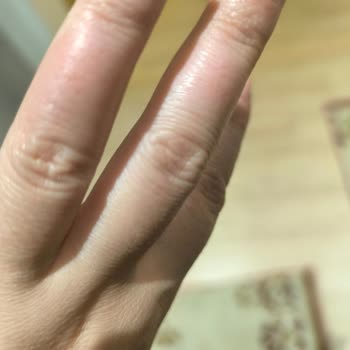 Glint Temizlik Ürünü Fırınıma Ve Sağlığıma Ciddi Zarar Verdi