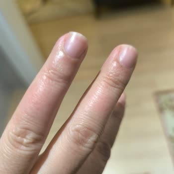 Glint Temizlik Ürünü Fırınıma Ve Sağlığıma Ciddi Zarar Verdi