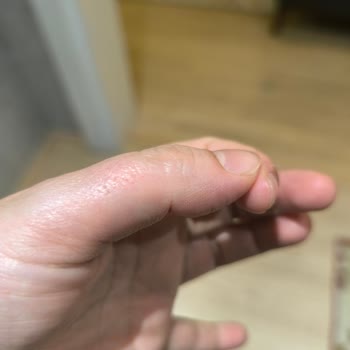 Glint Temizlik Ürünü Fırınıma Ve Sağlığıma Ciddi Zarar Verdi