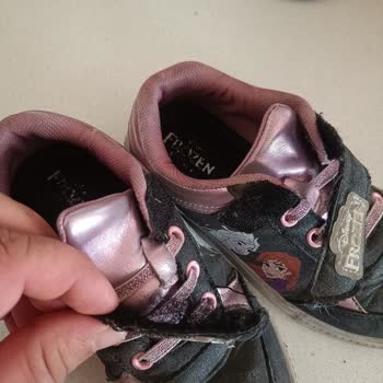 İki Ayda Bozulan Çocuk Ayakkabısına Değişim Reddi Mağduriyeti