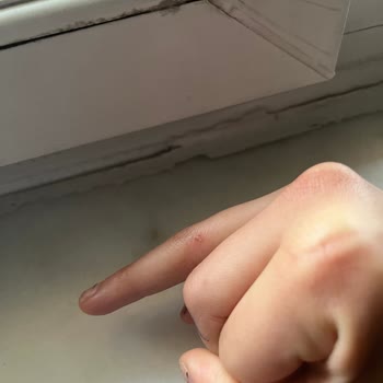 Aldığım Saç Yağı Kapağı Çatladı Ve Elim Kesildi