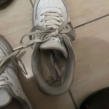 Çocuğumun Ayağını Yaralayan Ayakkabıya Değişim Reddi