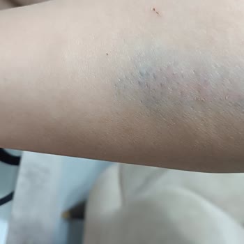 A101 Mağazasında Güvenlik Zafiyeti Ve Personel Duyarsızlığı Nedeniyle Yaşanan Kaza