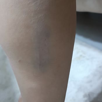 A101 Mağazasında Güvenlik Zafiyeti Ve Personel Duyarsızlığı Nedeniyle Yaşanan Kaza