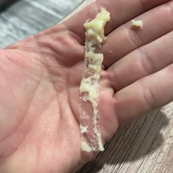 Kumpirin İçinden Bant Çıktı: Hijyen Skandalı