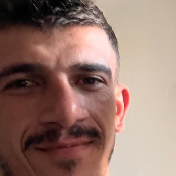 Başarısız Burun Ameliyatı Sonrası Mağduriyet Ve Revizyon Talebi